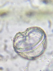 Peridinium gatunense