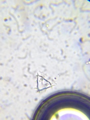 Staurastrum avicula