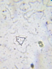 Staurastrum avicula