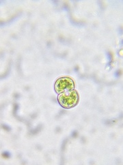 Cosmarium contractum