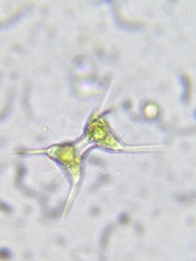 Staurodesmus extensus