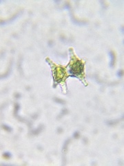 Staurastrum anatinum