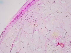 Asterodiaspis quercicola