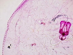 Asterodiaspis quercicola