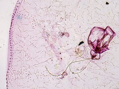 Asterodiaspis quercicola