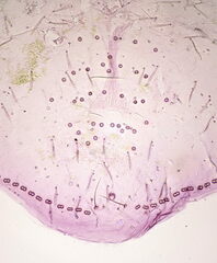 Asterodiaspis quercicola