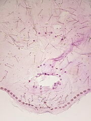 Asterodiaspis quercicola