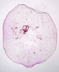 Asterodiaspis quercicola