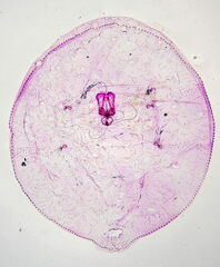 Asterodiaspis quercicola