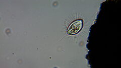 Cyclidium glaucoma