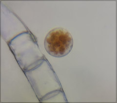 Chytridiomycota