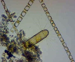 Corethron