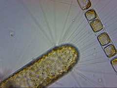 Corethron