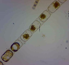 Stephanopyxis palmeriana