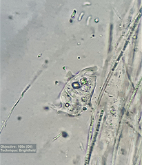 Amoebozoa