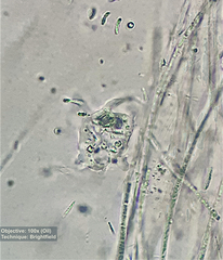 Amoebozoa