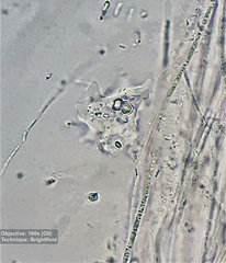 Amoebozoa
