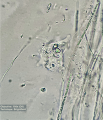 Amoebozoa