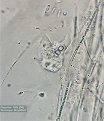 Amoebozoa