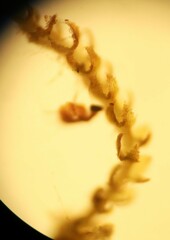 Cephaloziella turneri