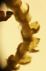 Cephaloziella turneri