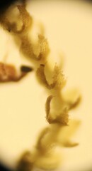 Cephaloziella turneri