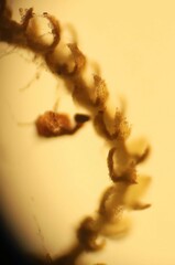 Cephaloziella turneri