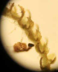 Cephaloziella turneri