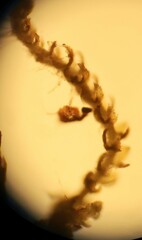 Cephaloziella turneri