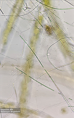 Bacteria