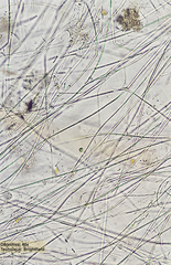 Bacteria