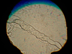 Peziza griseorosea