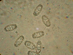 Peziza griseorosea