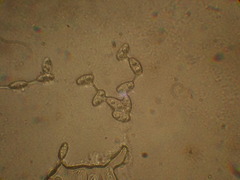 Peziza griseorosea