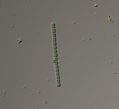Anabaena