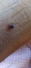 Dermacentor reticulatus