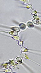 Asterionellopsis glacialis