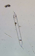 Rhizosoleniales