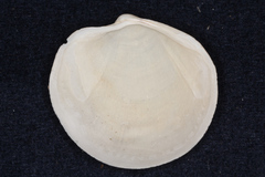 Anodontia