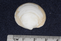 Anodontia