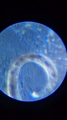 Nematoda