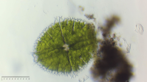 Micrasterias fimbriata