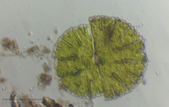 Micrasterias denticulata