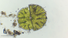 Micrasterias denticulata