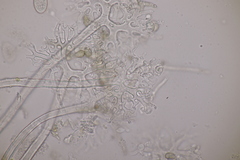 Erysiphe palczewskii