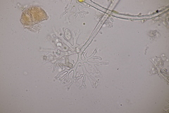 Erysiphe palczewskii