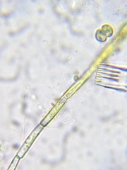 Cosmarium