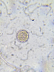 Heliozoa
