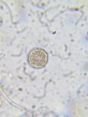 Heliozoa