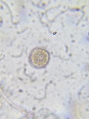 Heliozoa